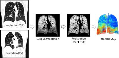 Nasal High Flow at 25 L/min or Expiratory Resistive Load Do Not Improve Regional Lung Function in Patients With COPD: A Functional CT Imaging Study